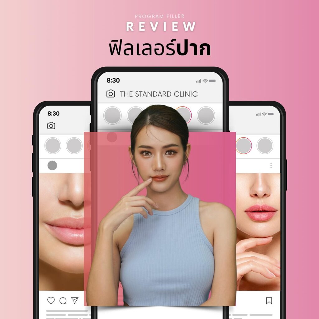 ริวิวฟิลเลอร์ปาก